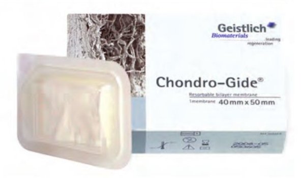 Chondro-Gide